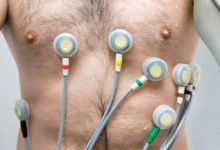 Ekg Testing Locations Near Me
