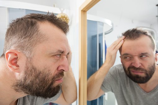 hair transplant cost