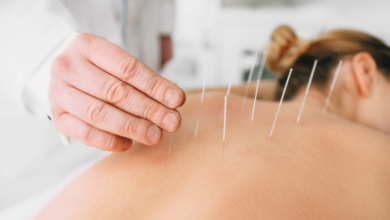 Acupuncture for pain relief