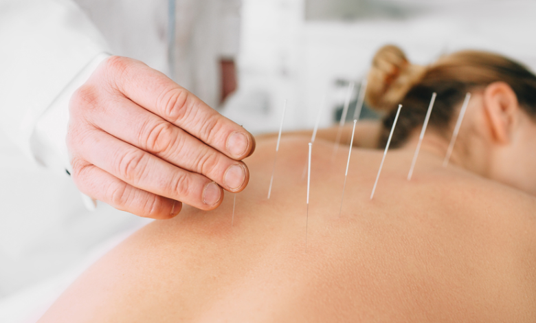 Acupuncture for pain relief