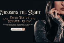 laser tattoo removal clinic