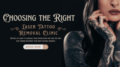 laser tattoo removal clinic