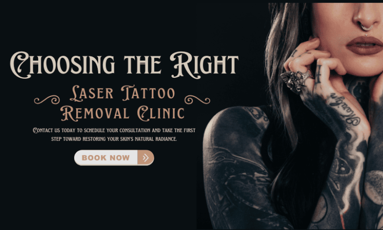 laser tattoo removal clinic