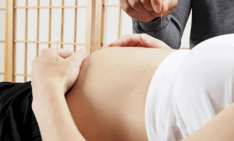 acupuncture for IVF